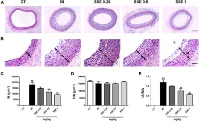 Sodium Selenite Attenuates Balloon Injury-Induced and Monocrotaline-Induced Vascular Remodeling in Rats